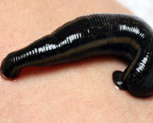 SEHSCHWÄCHE NATÜRLICH BEHEBEN