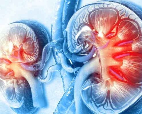 CHRONISCHE NIERENERKRANKUNG