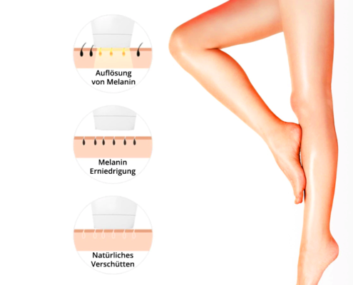 NIE WIEDER DIE BEINE RASIEREN