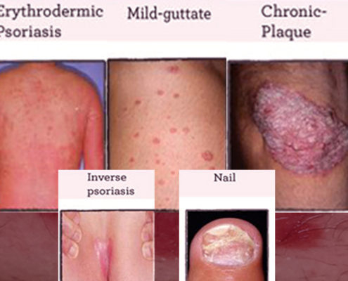 Gesichts- und Hautflecken entfernen