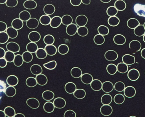 DUNKELFELDMIKROSKOPIE