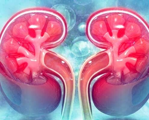 NEPHROTISCHES SYNDROM