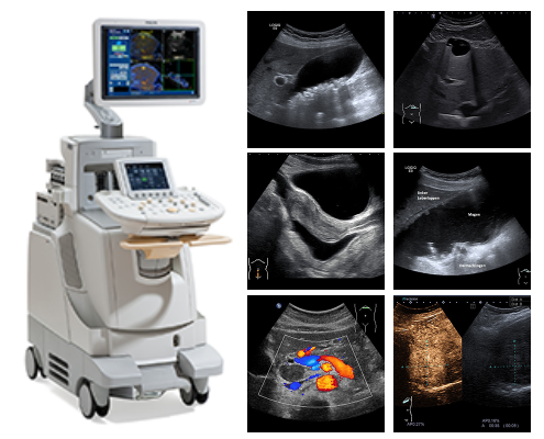 ULTRASCHALL (SONOGRAPHIE)