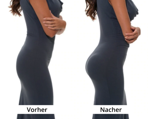 Po-Vergrösserung – mit Vakuum-Therapie